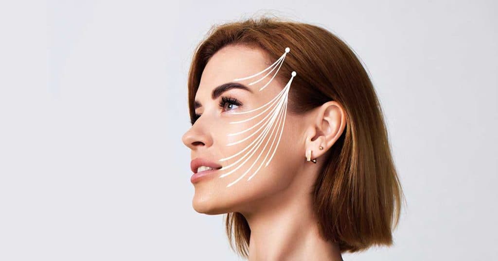 Fios de PDO – Espiculado